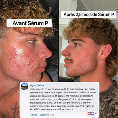 Sérum Peptides, Réparateur (30ml)
