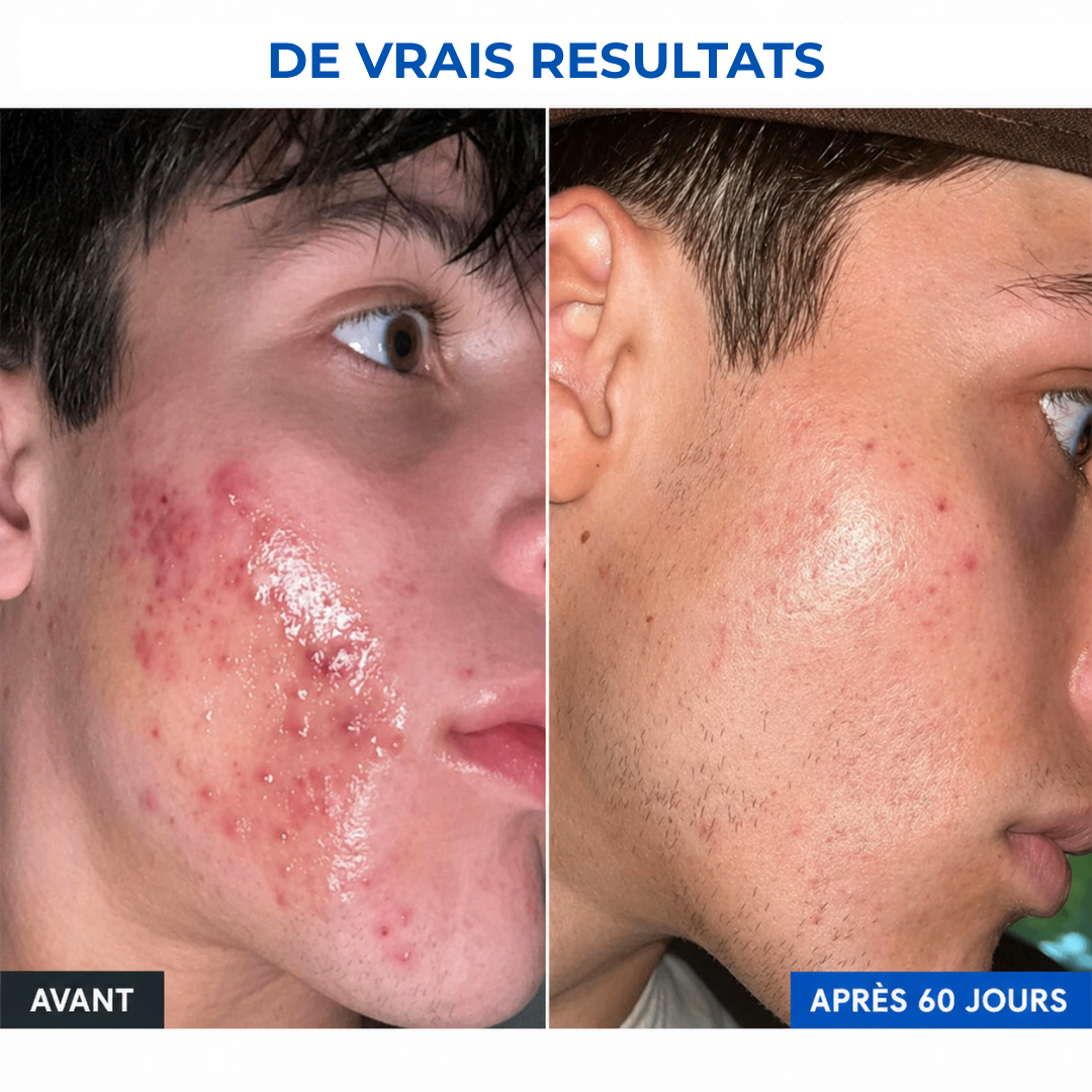 Sérum Peptides, Réparateur (30ml)